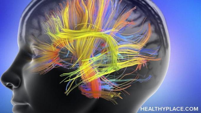 Din PTSD-ramte hjerne har brug for hjælp til at motivere sig selv til at helbrede. PTSD får din hjerne til at rive sig i traumet. Du kan lære din hjerne at helbrede. Sådan gør du.