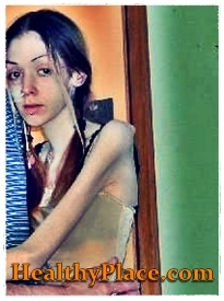 På dette foto af selvskading, engagerer en pige med anoreksi sig selvskader ved at slå og mærke dele af hendes krop